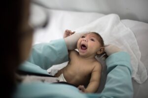 Read more about the article Estudo relaciona desnutrição de mães com agravamento dos efeitos do vírus da zika na malformação de fetos
