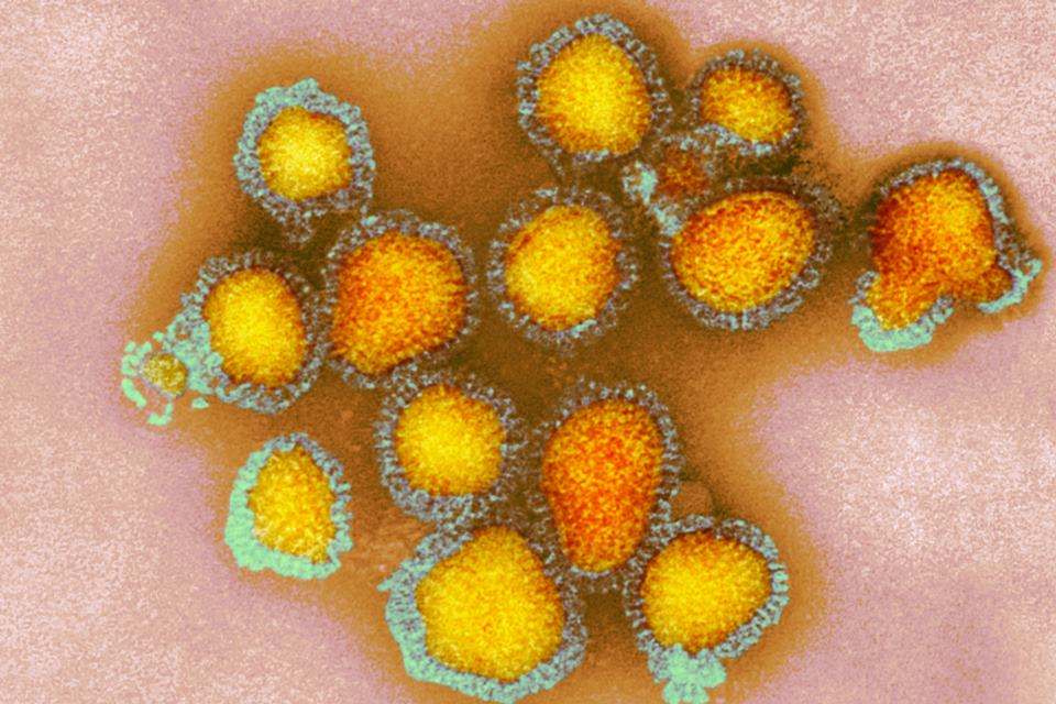 Read more about the article Pernambuco confirma três primeiros casos de Influenza A H3N2