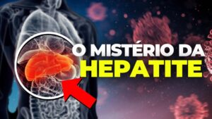 Read more about the article Estado de Pernambuco descarta 1, dos 3 casos notificados para hepatite misteriosa