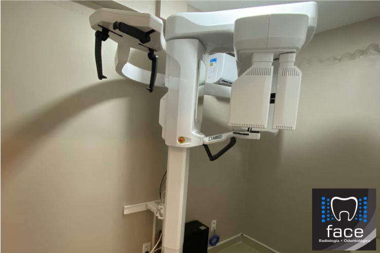 Read more about the article São José do Egito e região agora contam com serviço de tomografia odontológica
