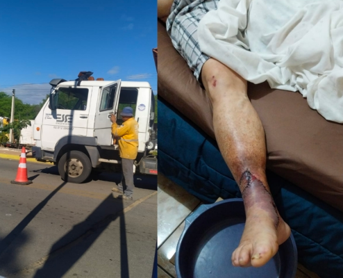 Leia mais sobre o artigo Homem tem pé amputado após bater em haste sem sinalização que estava em caminhão que trabalhava pro DER