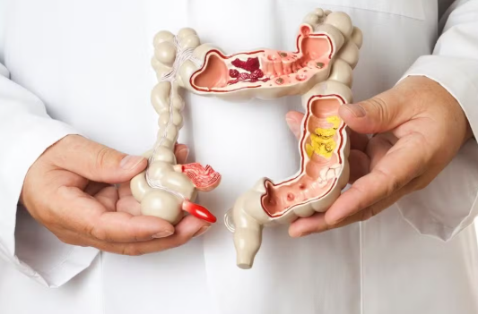 Leia mais sobre o artigo Diagnóstico precoce pode curar mais de 90% dos casos de câncer de intestino